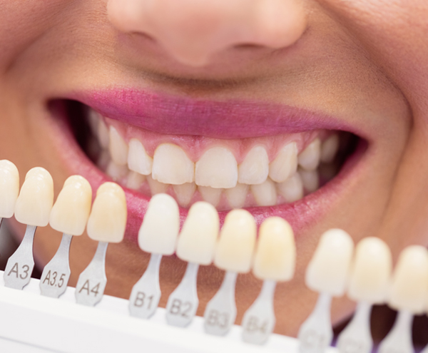 Root Canal Treatment 